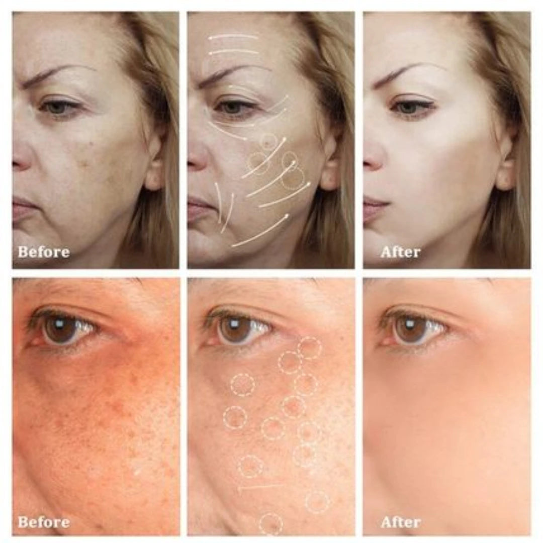 Crema Elimina Pecas Manchas Oscuras Y Melasma⭐